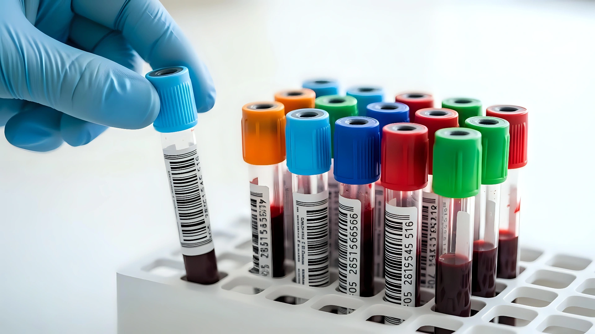 Advanced Diagnostics and Personalized Treatment